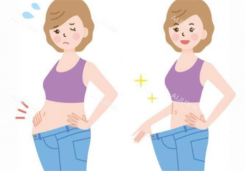 腰腹吸脂 腰腹吸脂