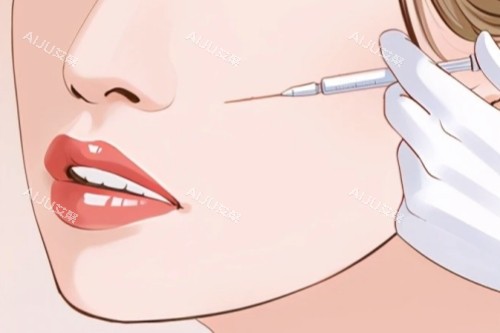 面部注射卡通一览 面部注射卡通一览