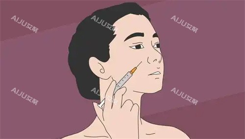面部注射图 面部注射图
