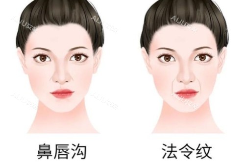 鼻唇沟和法令纹卡通对比图