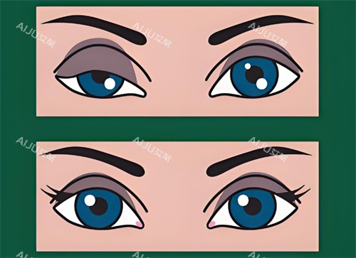 矫正前后对比 矫正前后对比