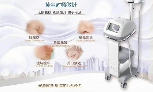 伊诺锶黄金微针治疗部位示意图 伊诺锶黄金微针治疗部位示意图