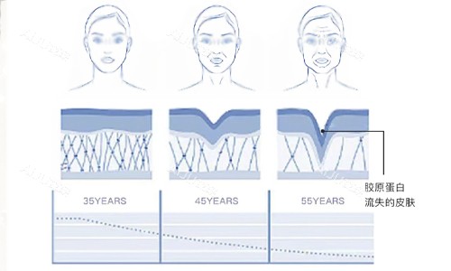 胶原蛋白流失的皮肤