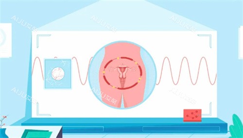 私密紧致卡通图 私密紧致卡通图