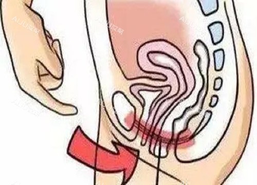 女性私密整形位置示意图 女性私密整形位置示意图