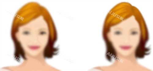 热玛吉前后对比 热玛吉前后对比