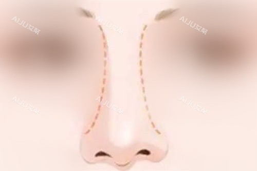 鼻部形态曲线展示图 鼻部形态曲线展示图