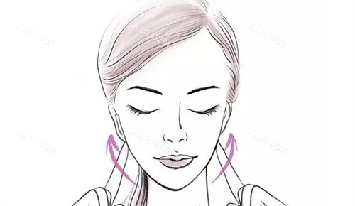 提升手术 提升手术