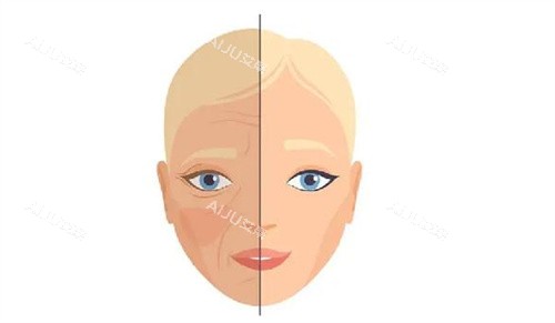 面部除皱对比 面部除皱对比