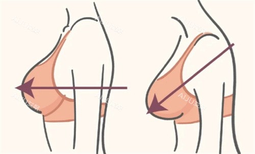 缩胸手术术前术后