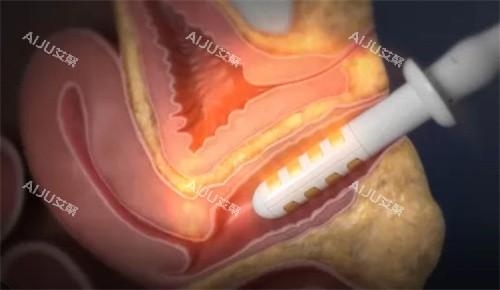 半岛FemeTite操作方式 半岛FemeTite操作方式