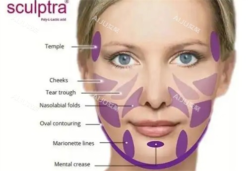 舒颜萃童颜针可治疗部位 舒颜萃童颜针可治疗部位