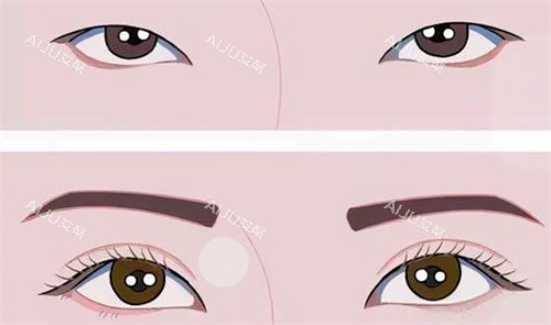 双眼皮前后对比