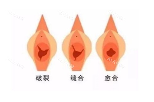 私密整形治疗图片展示