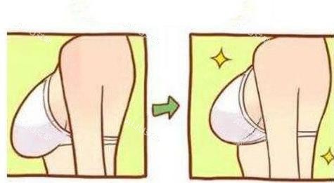 乳房提升手术 乳房提升手术