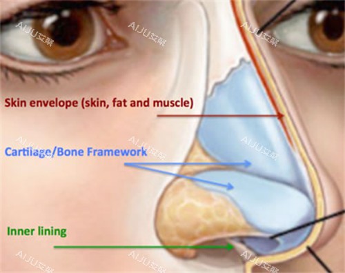 长鼻修复矫正对比