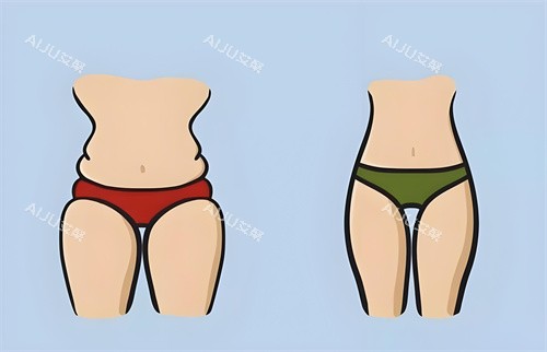 腿部吸脂手术前后对比正面动画图 腿部吸脂手术前后对比正面动画图