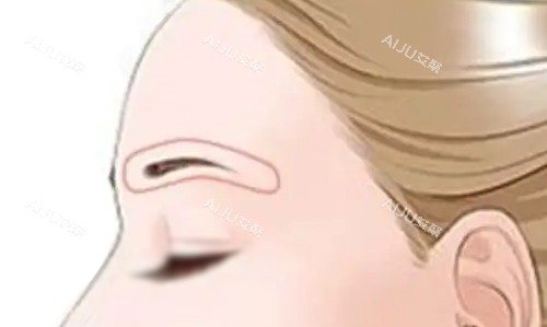 眉弓部位展示 眉弓部位展示