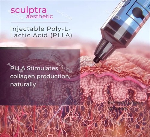 塑妍萃注射深度 塑妍萃注射深度