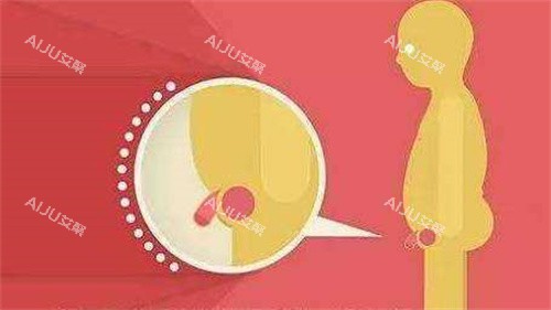 阴茎短小演示动画图 阴茎短小演示动画图