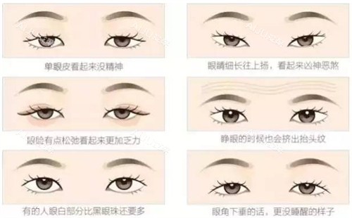 不同可以进行双眼皮的眼睛 不同可以进行双眼皮的眼睛