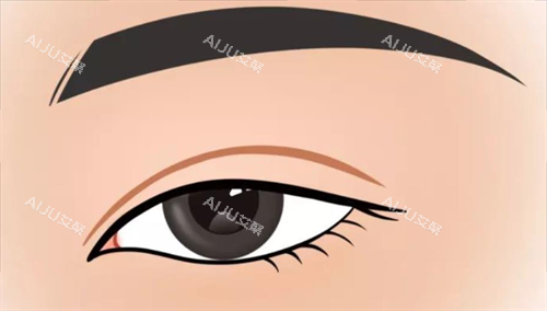 双眼皮形态展示