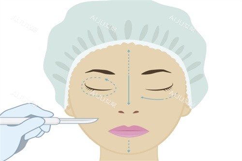 眼综合手术卡通图