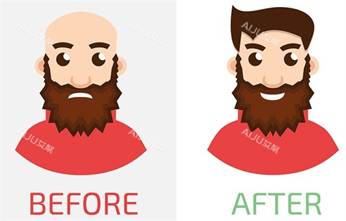 植发手术对比图 植发手术对比图