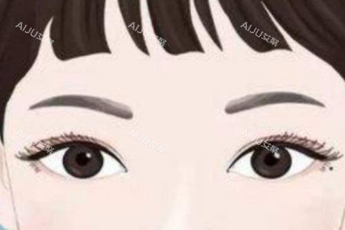 全切双眼皮卡通图一览 全切双眼皮卡通图一览