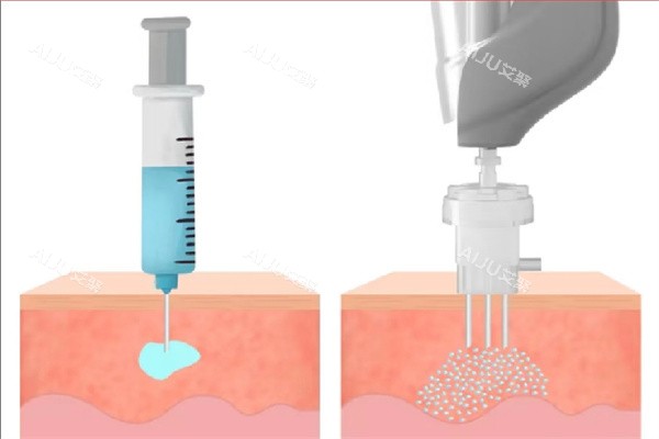 ***注射方式 ***注射方式