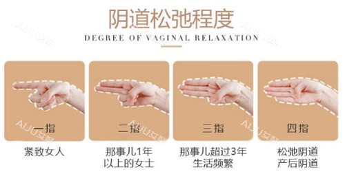 阴道松弛程度图示 阴道松弛程度图示