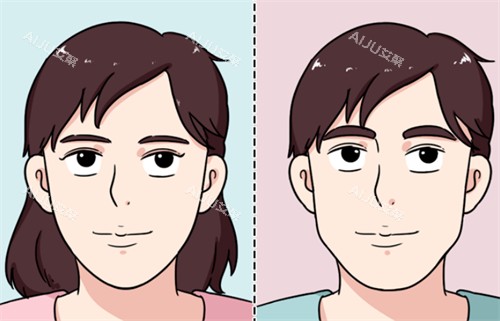 变性手术前后的变化 变性手术前后的变化