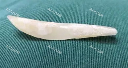 隆鼻假体图片 隆鼻假体图片