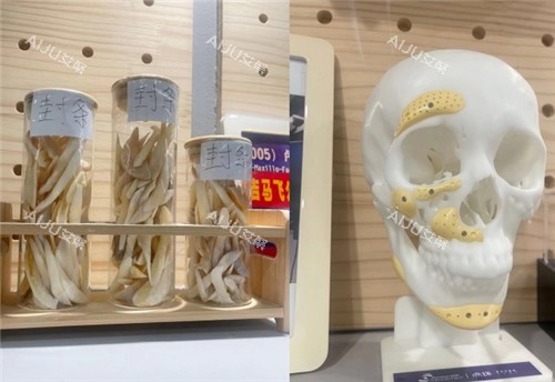 重庆松山医院截骨骨头整理区域图