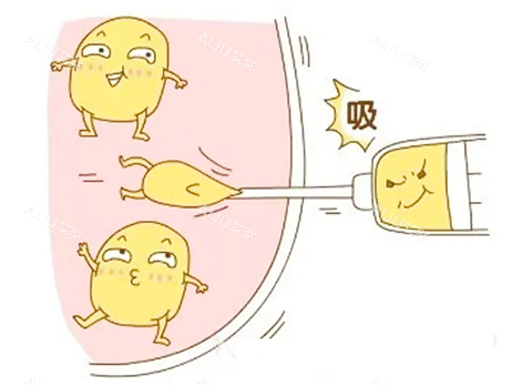 吸脂生动卡通图