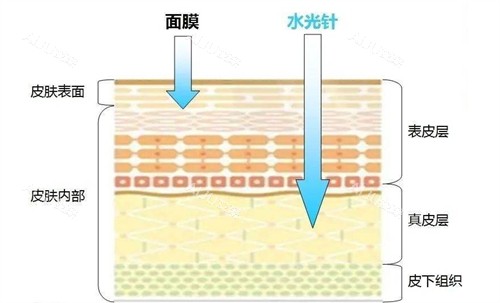 水光补水和面膜补水的区别 水光补水和面膜补水的区别