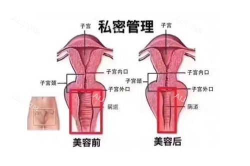 子宫概念图 子宫概念图