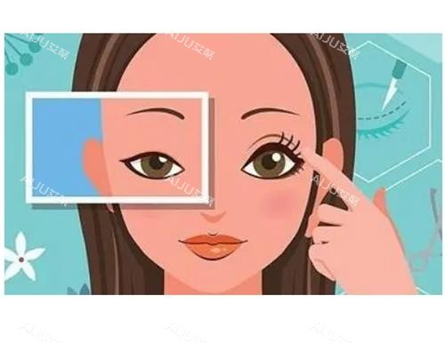 开眼角明显对比***图 开眼角明显对比***图