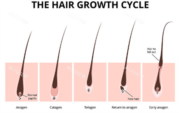单毛囊移植过程图解 单毛囊移植过程图解