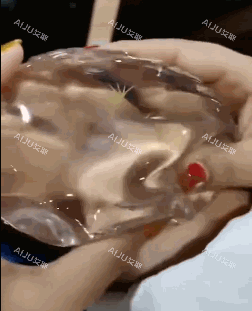 丰胸手术傲诺拉隆胸假体手感 丰胸手术傲诺拉隆胸假体手感