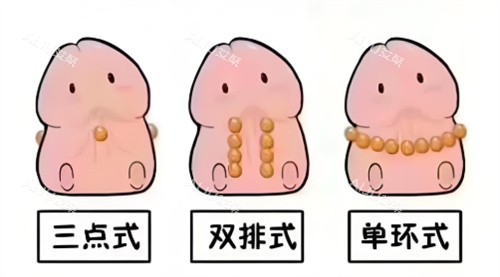 入珠手术动画2 入珠手术动画2