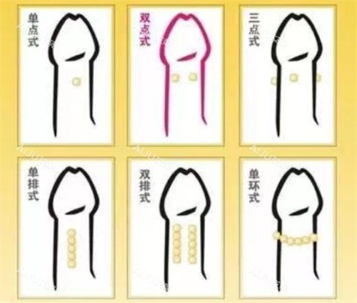 阴茎入珠术款式 阴茎入珠术款式