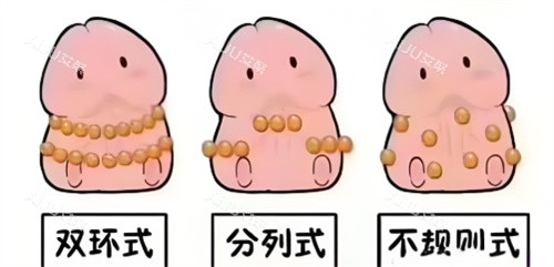 入珠手术动画3 入珠手术动画3