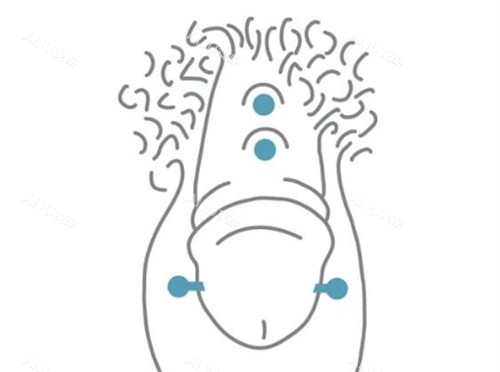 阴茎入珠术后 阴茎入珠术后