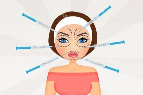 面部注射玻尿酸卡通图