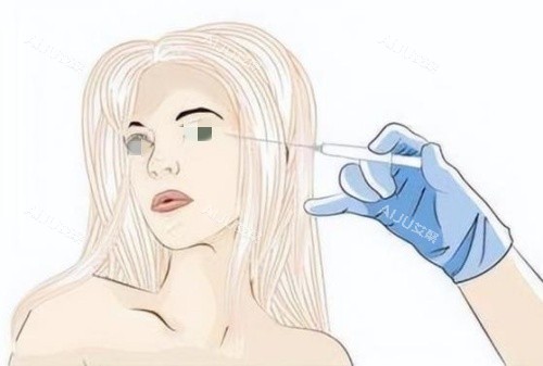 注射胶原蛋白去泪沟示意图