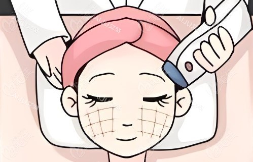 热玛吉操作过程