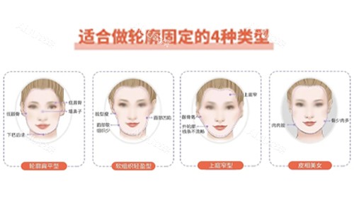 面部轮廓固定适合类型 面部轮廓固定适合类型