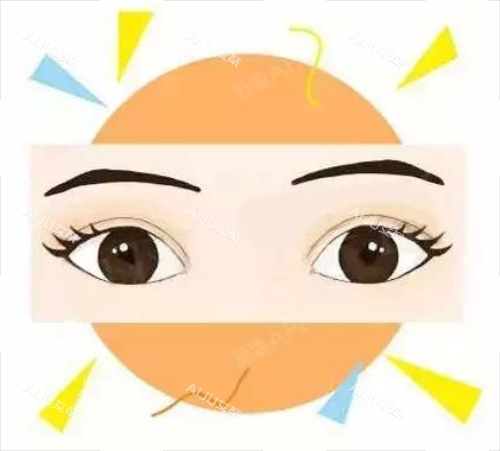 全切双眼皮***图 全切双眼皮***图