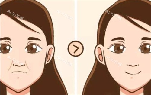 法令纹前后对比